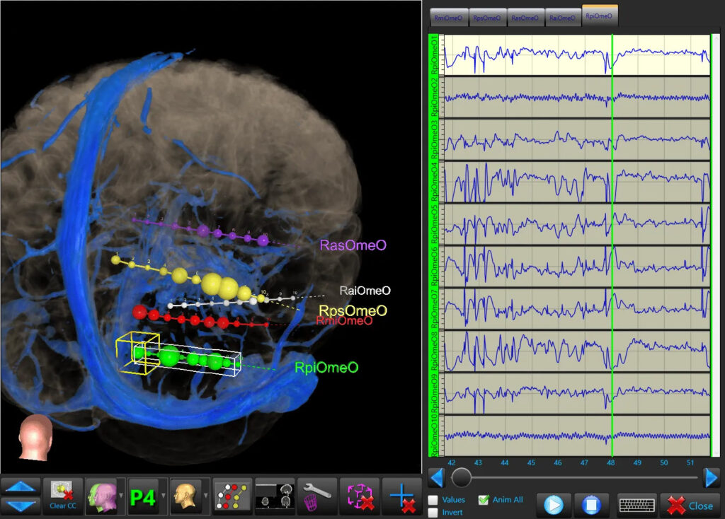 BrainSTORM Facilitate