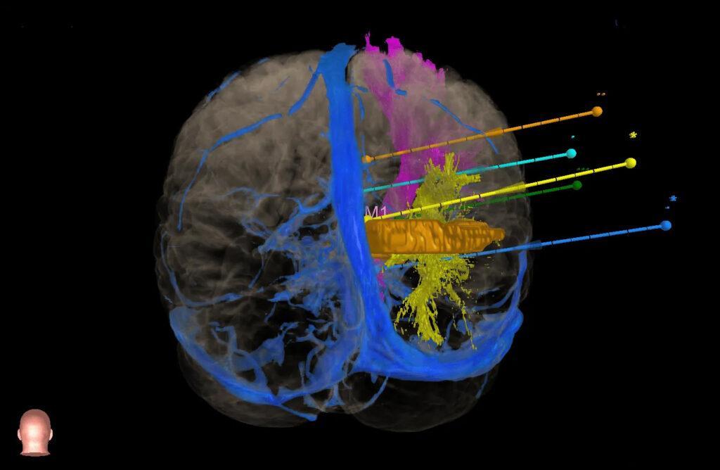 BrainSTORM Integrate